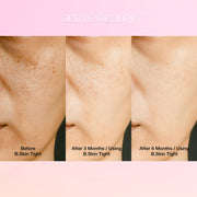 Skin Tightening Collagen Booster – B.Skin Tight 10 Pack Organic Wild Berry