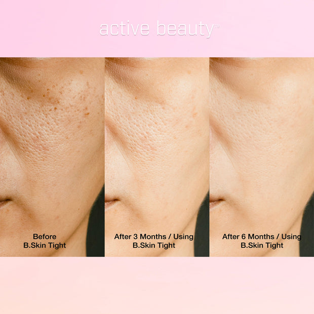 Skin Tightening Collagen Booster – B.Skin Tight 10 Pack Organic Wild Berry